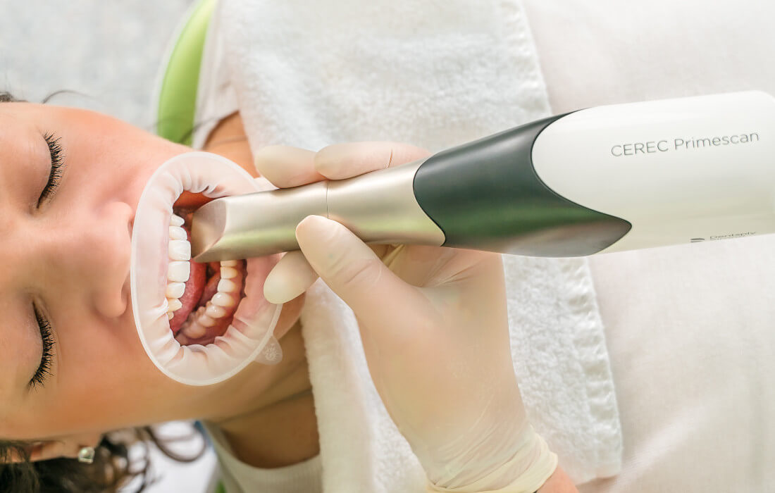 Intraoralscanner im Einsatz